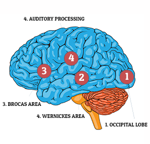 Diagram of the different parts of the brain